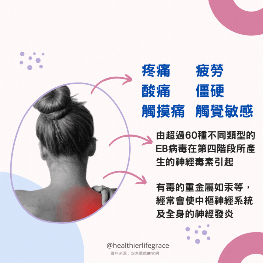 纖維肌痛症