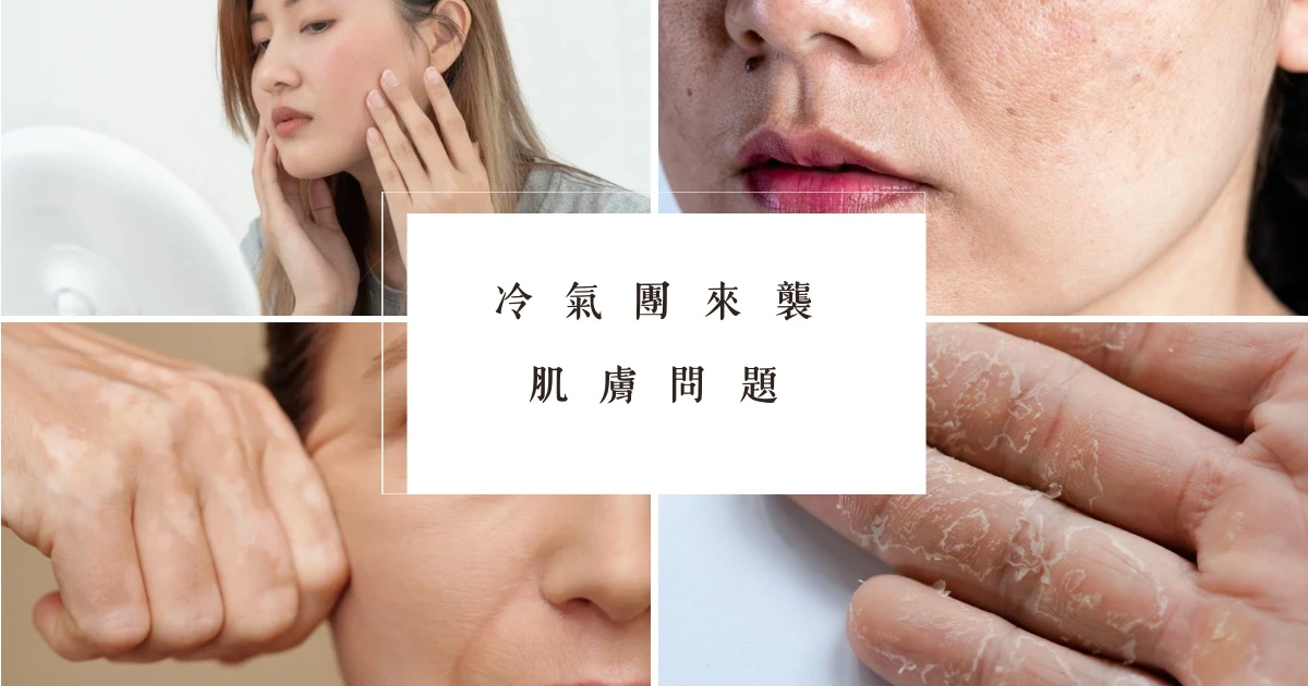 冷氣團來襲時,皮膚經常出現四大狀況
