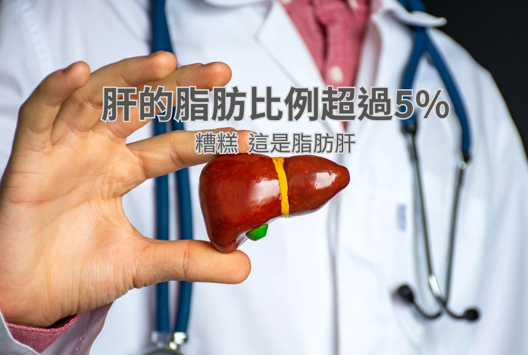 沒有症狀的健康警訊：脂肪肝患者25%終身恐發展為肝發炎