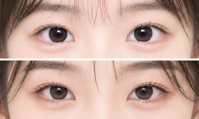 圓眼杏仁眼眼型示意圖