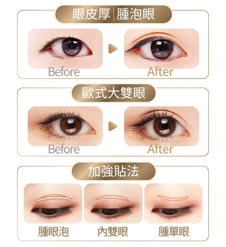 Before After 腫泡眼 內雙眼 歐式大雙眼
