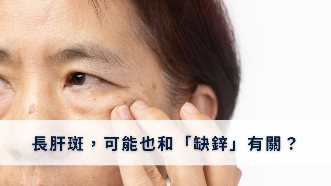 長肝斑，可能也和「缺鋅」有關？