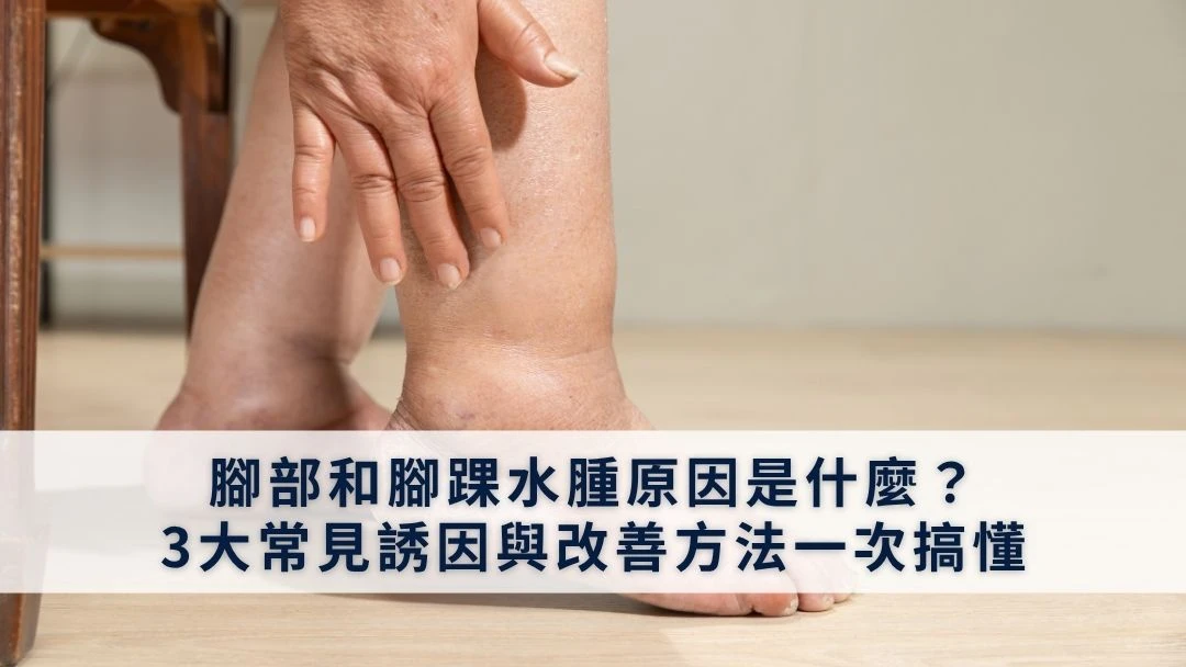 腳部和腳踝水腫原因是什麼？3大常見誘因與改善方法一次搞懂