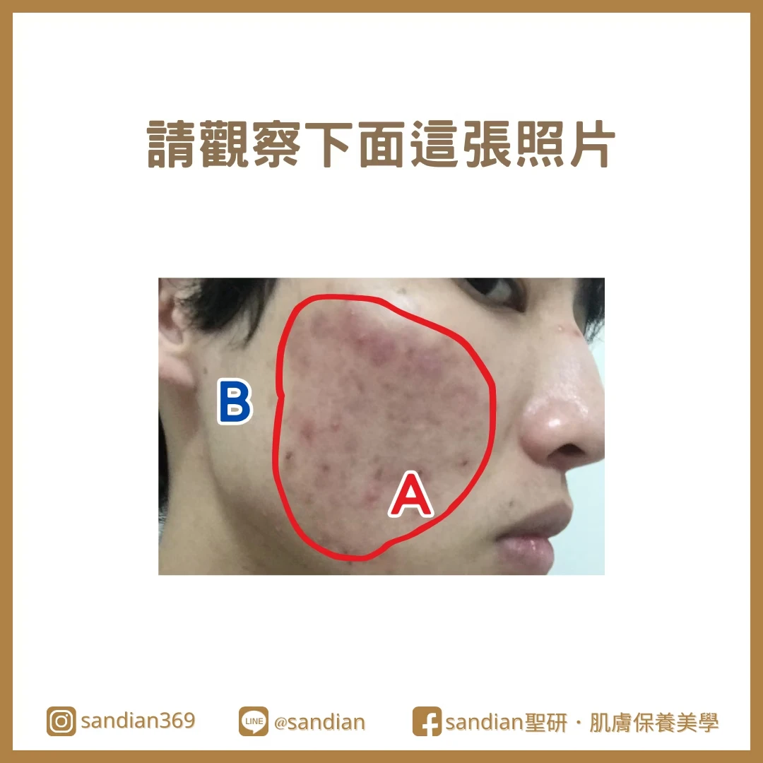 判斷你的皮膚屏障是不是受損
