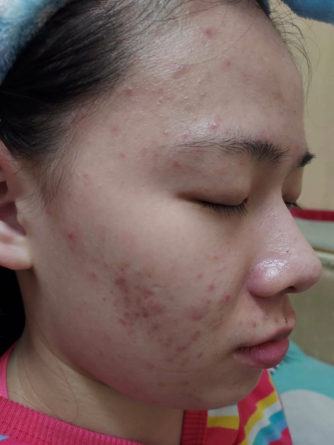 使用前照片