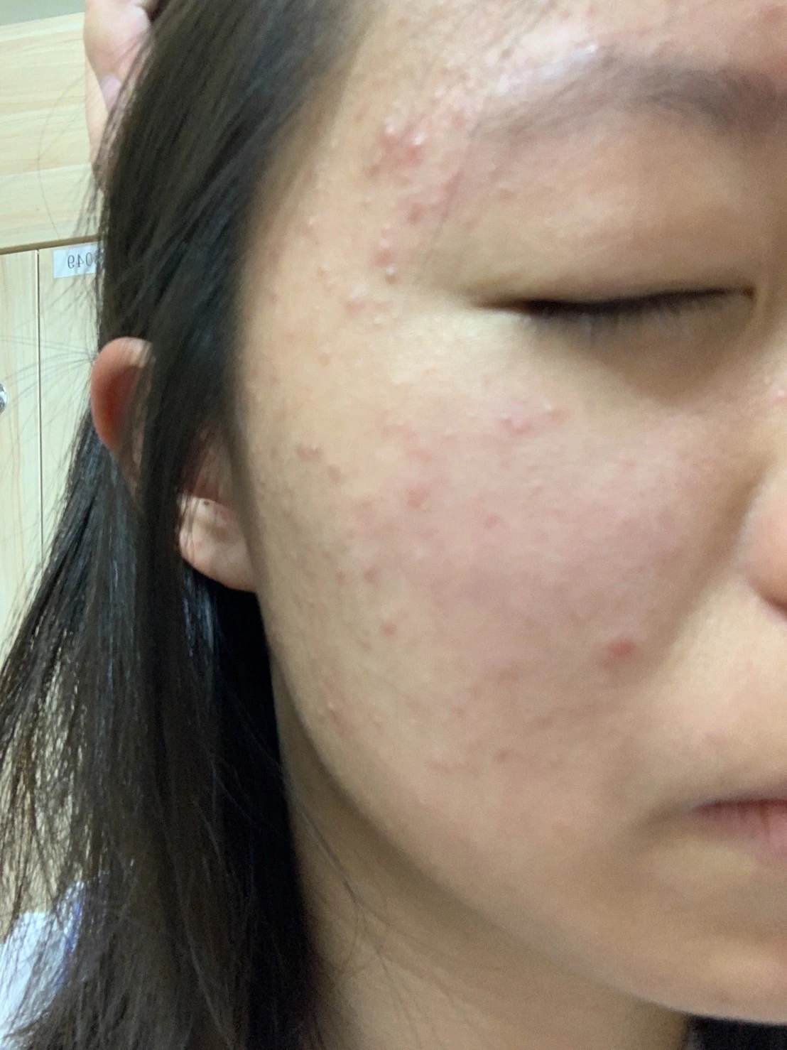 使用前照