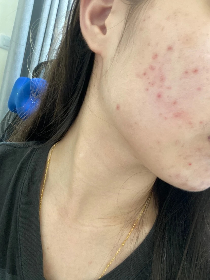 使用前照片