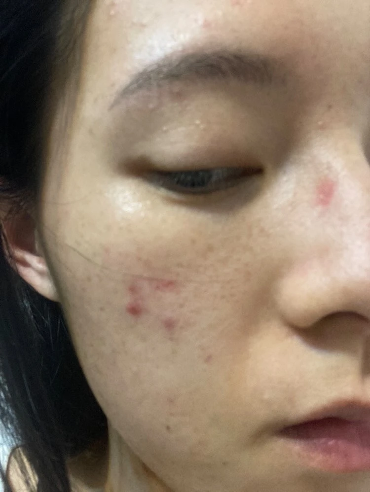 使用前照片