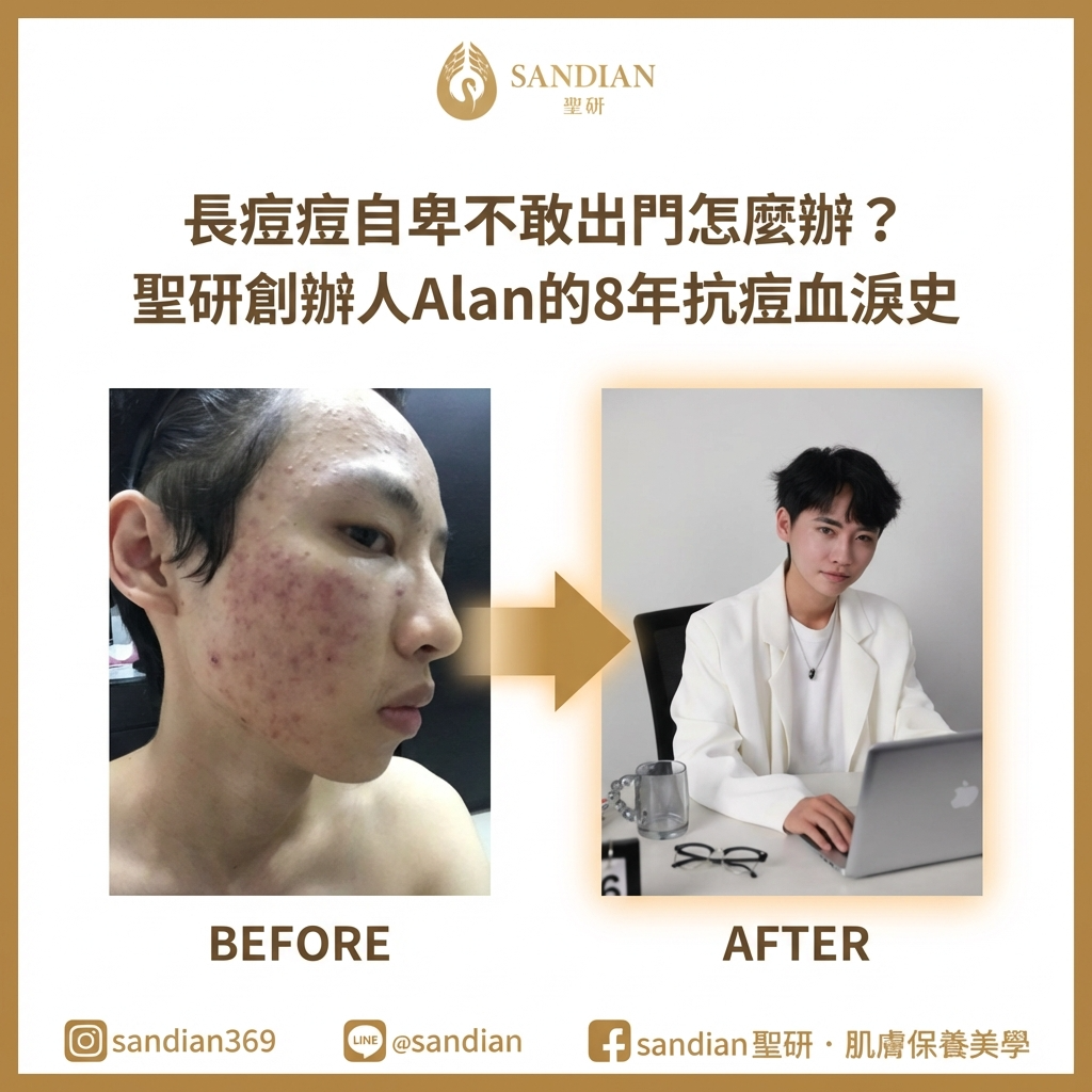 抗痘學長愛迪生