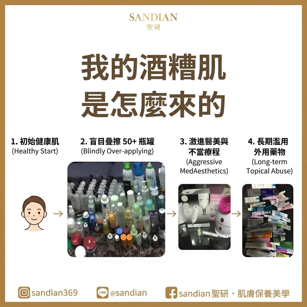 酒糟肌是怎麼來的