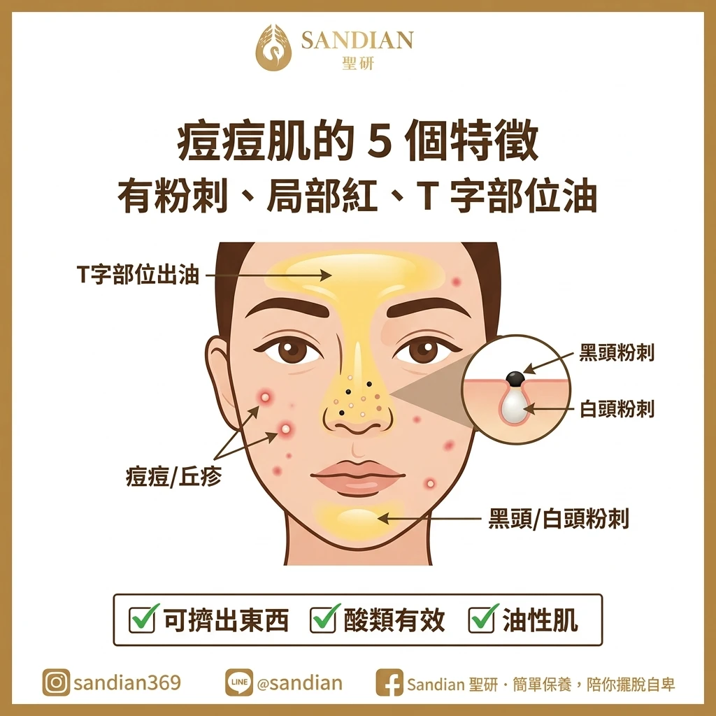 可以同時有酒糟肌和痘痘肌