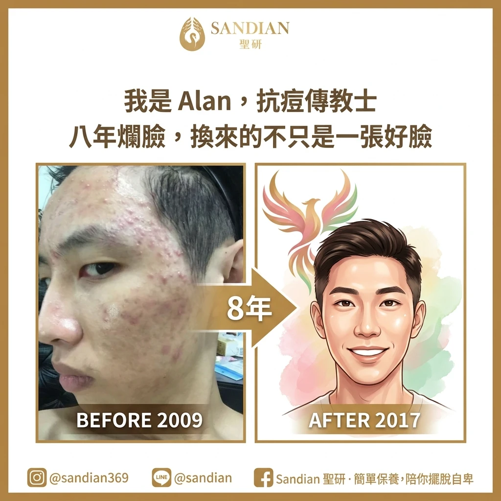 我是 Alan,抗痘傳教士:八年爛臉、花費百萬,換來的不只是一張好臉