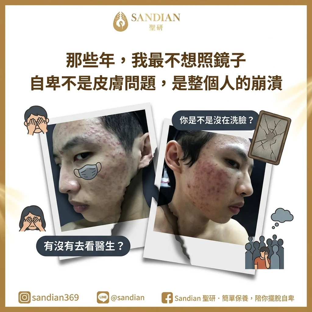 那些年,我最不想照鏡子 自卑不是皮膚問題,是整個人的崩潰