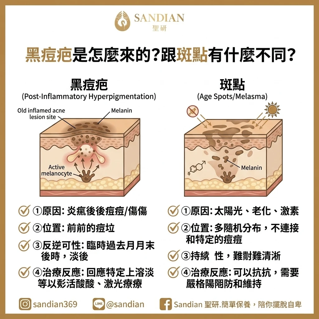黑痘疤是怎麼來的？跟斑點有什麼不同？