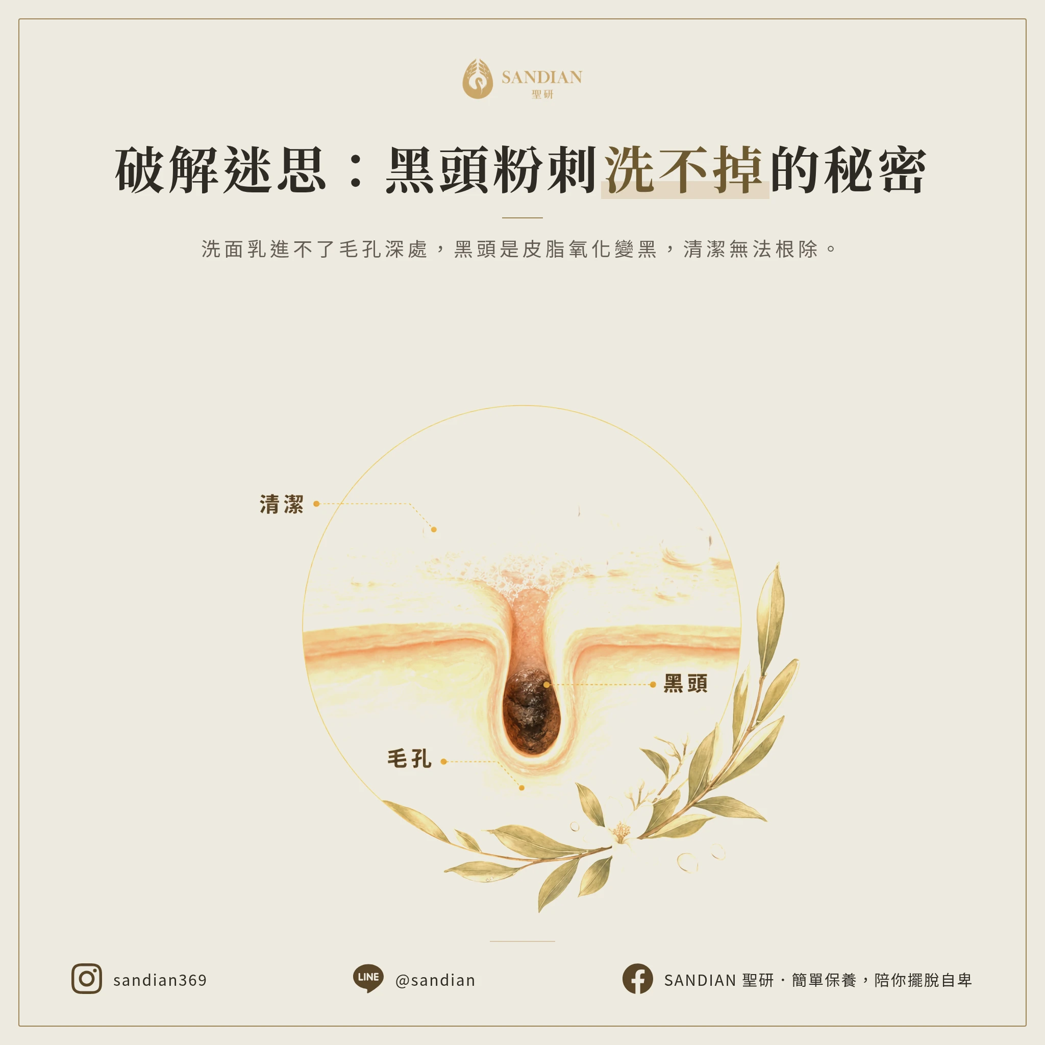 一、為什麼洗臉洗不掉黑頭?皮膚科醫師揭露真相