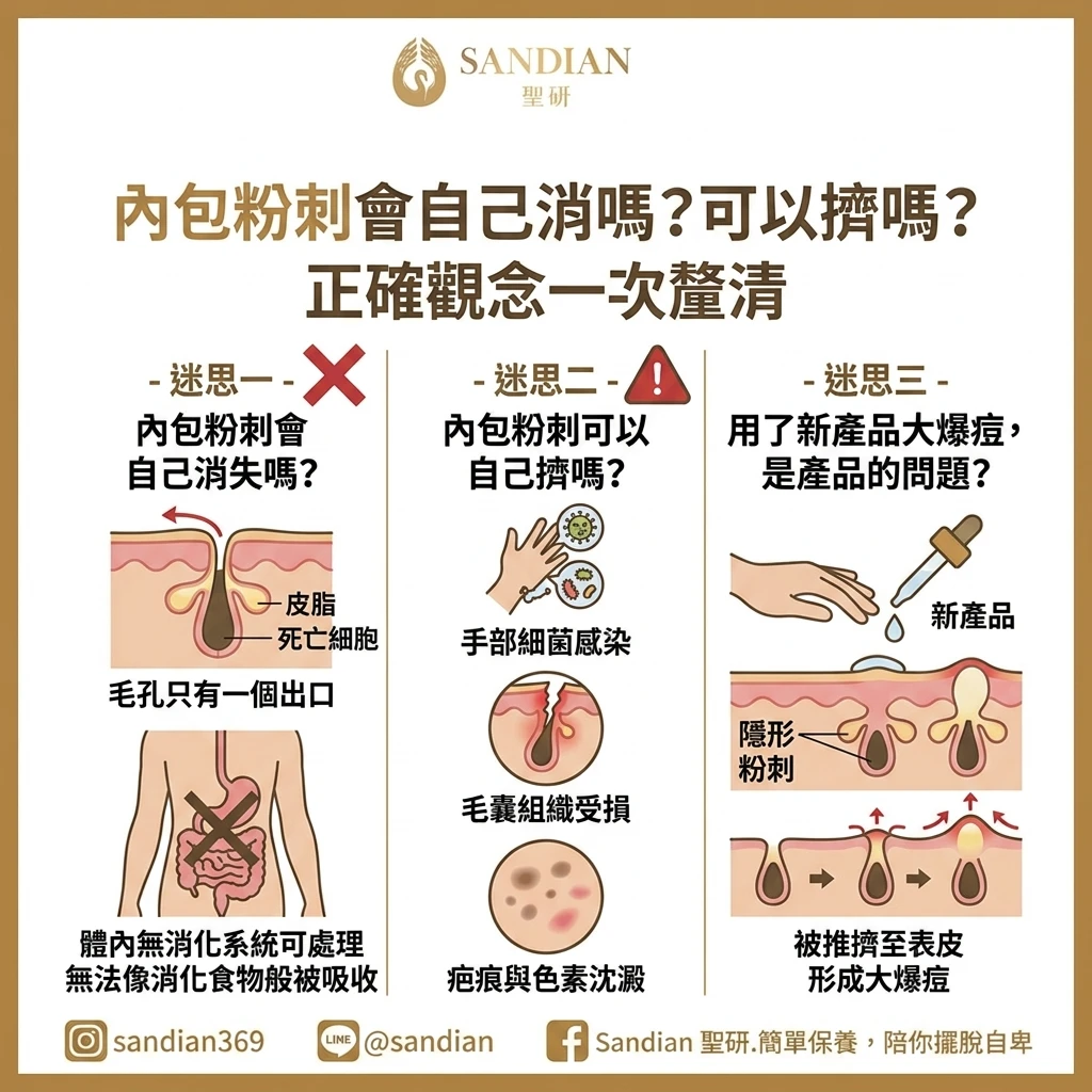 內包粉刺會自己消嗎?可以擠嗎?正確觀念一次釐清