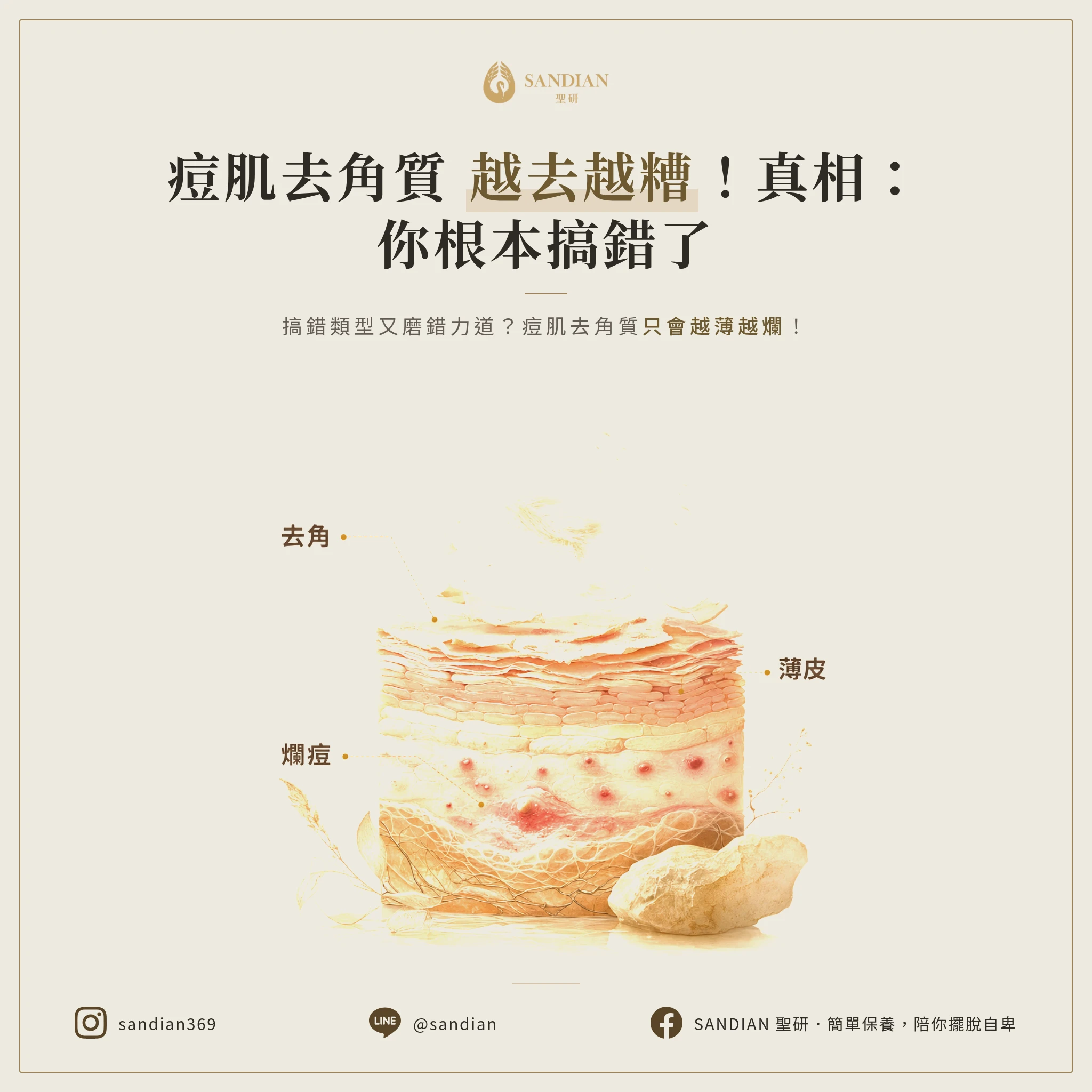 痘肌去角質,為什麼會越搞越糟
