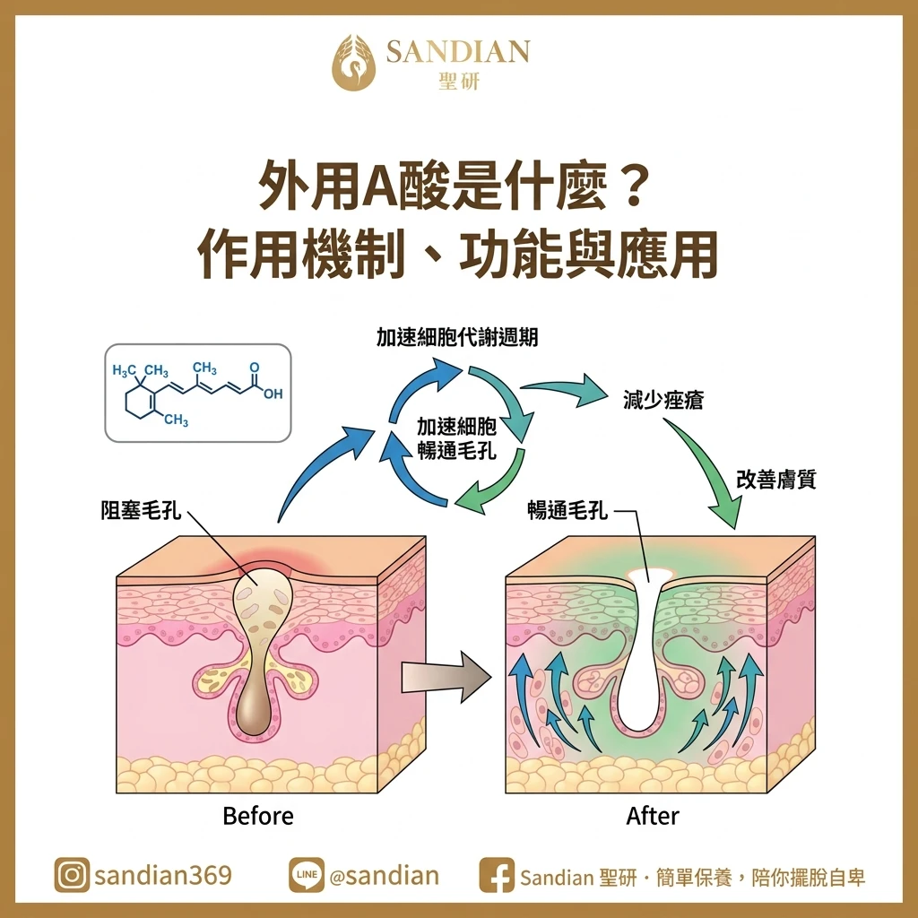 外用A酸是什麼?作用機制、功能與應用完整指南