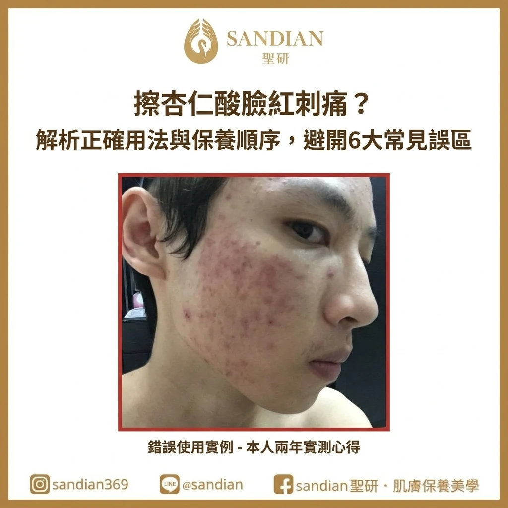 擦杏仁酸臉紅刺痛?解析正確用法與保養順序,避開 6 大常見誤區