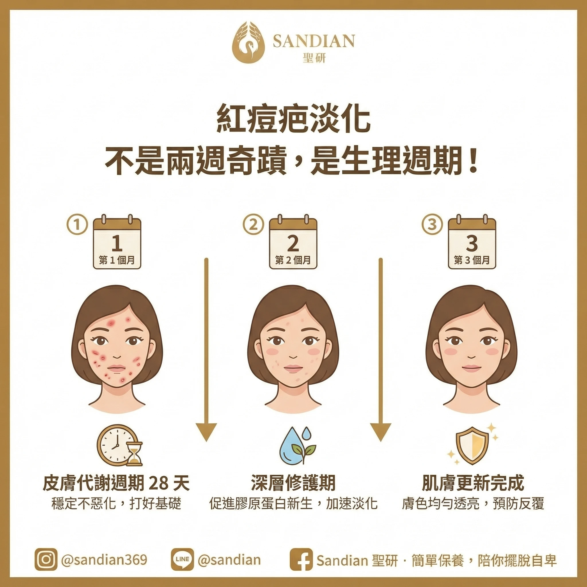 紅痘疤是發炎後血管擴張,代謝需要 3~4 個月