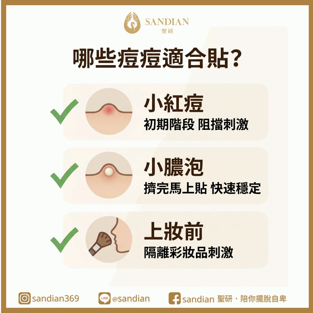 二、哪些痘痘貼了會比較快穩定?