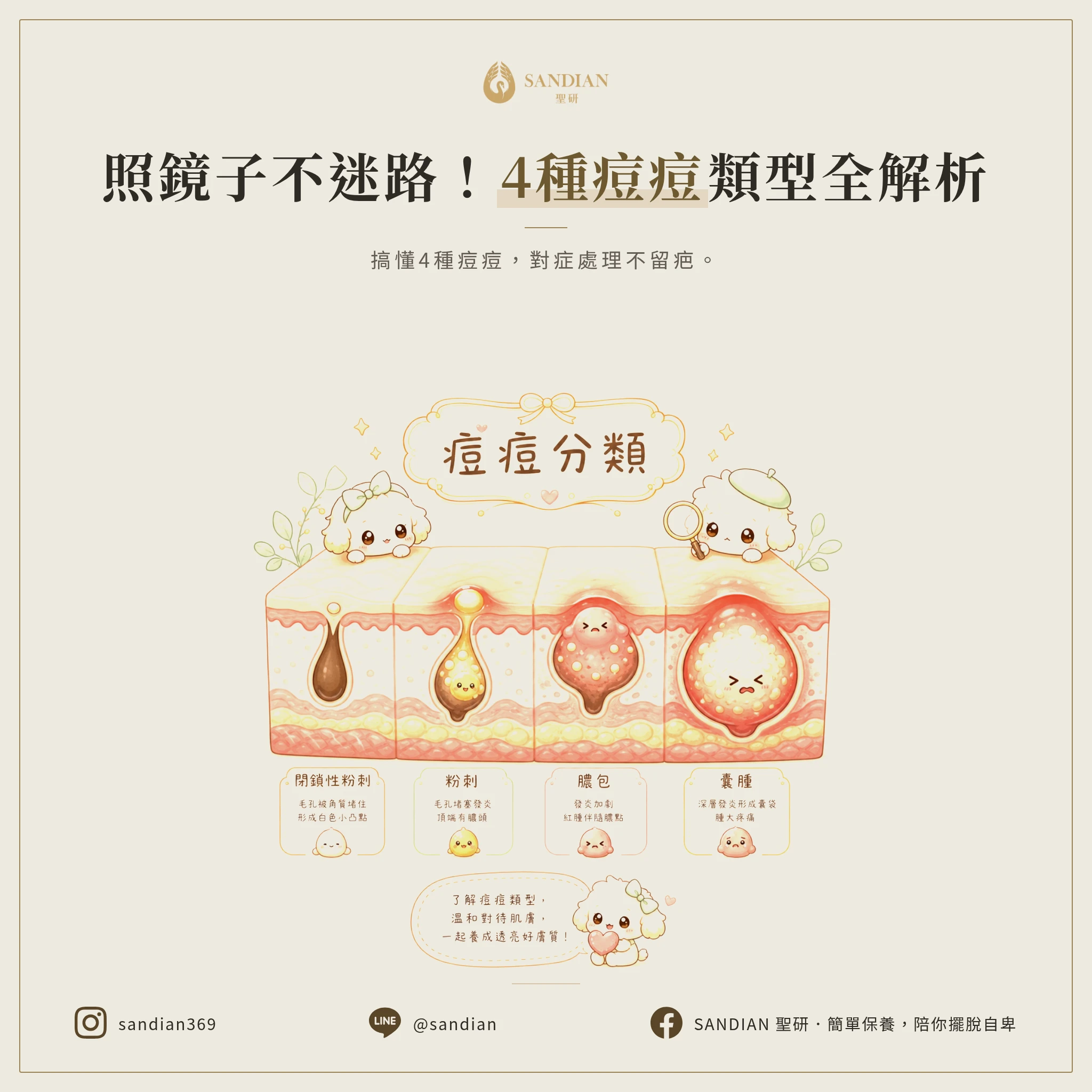 4 種痘痘怎麼分?囊腫、結節、膿包、閉鎖性辨識對照