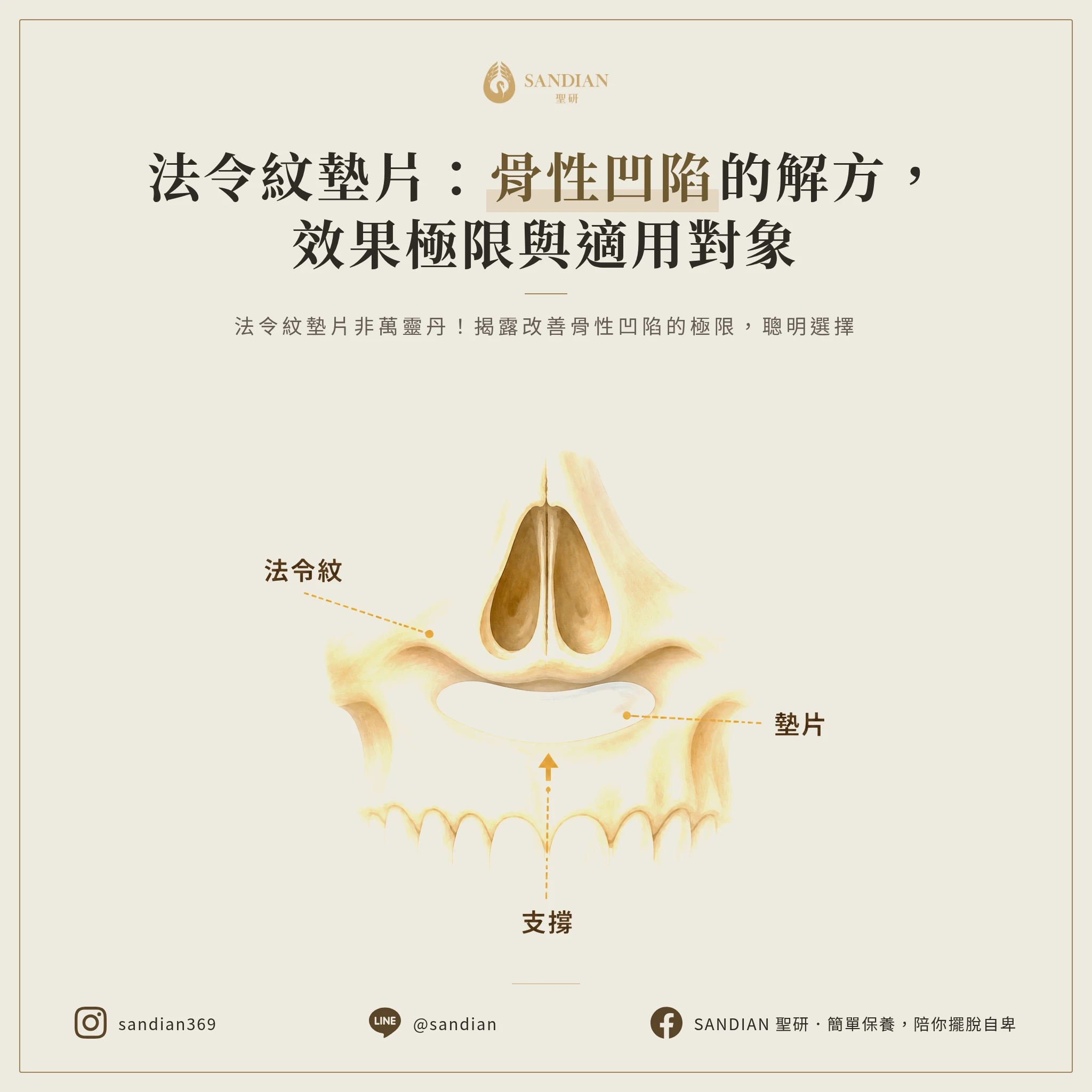 法令紋墊片(貴族手術)到底能改善多少?適合誰做