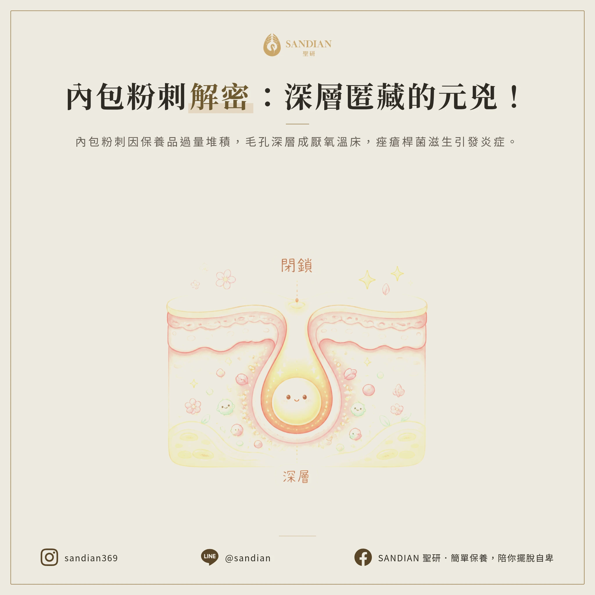 內包粉刺到底怎麼來的?為什麼會卡在皮膚深層?