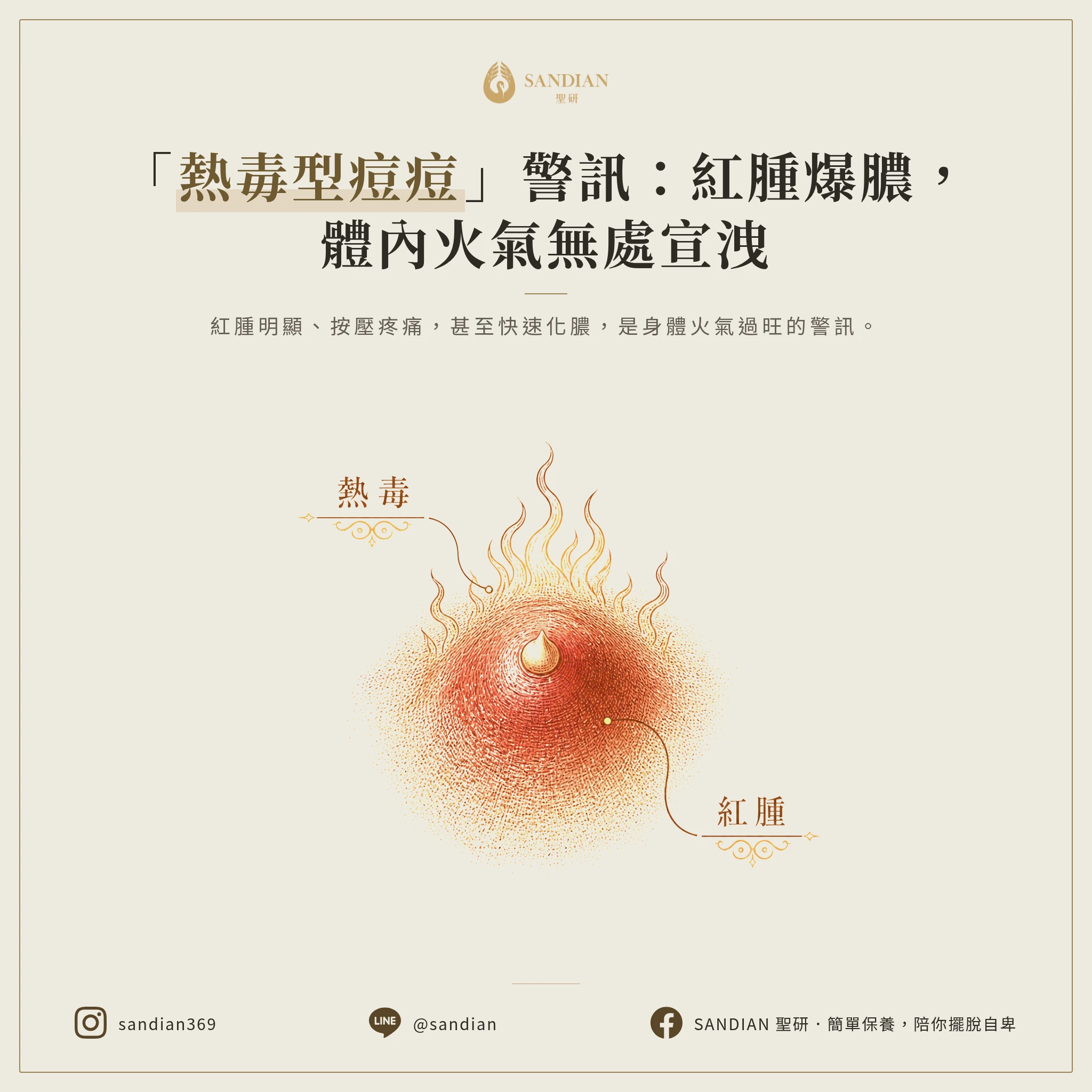 一、熱毒型痘痘:紅腫痛化膿,火氣大的警訊