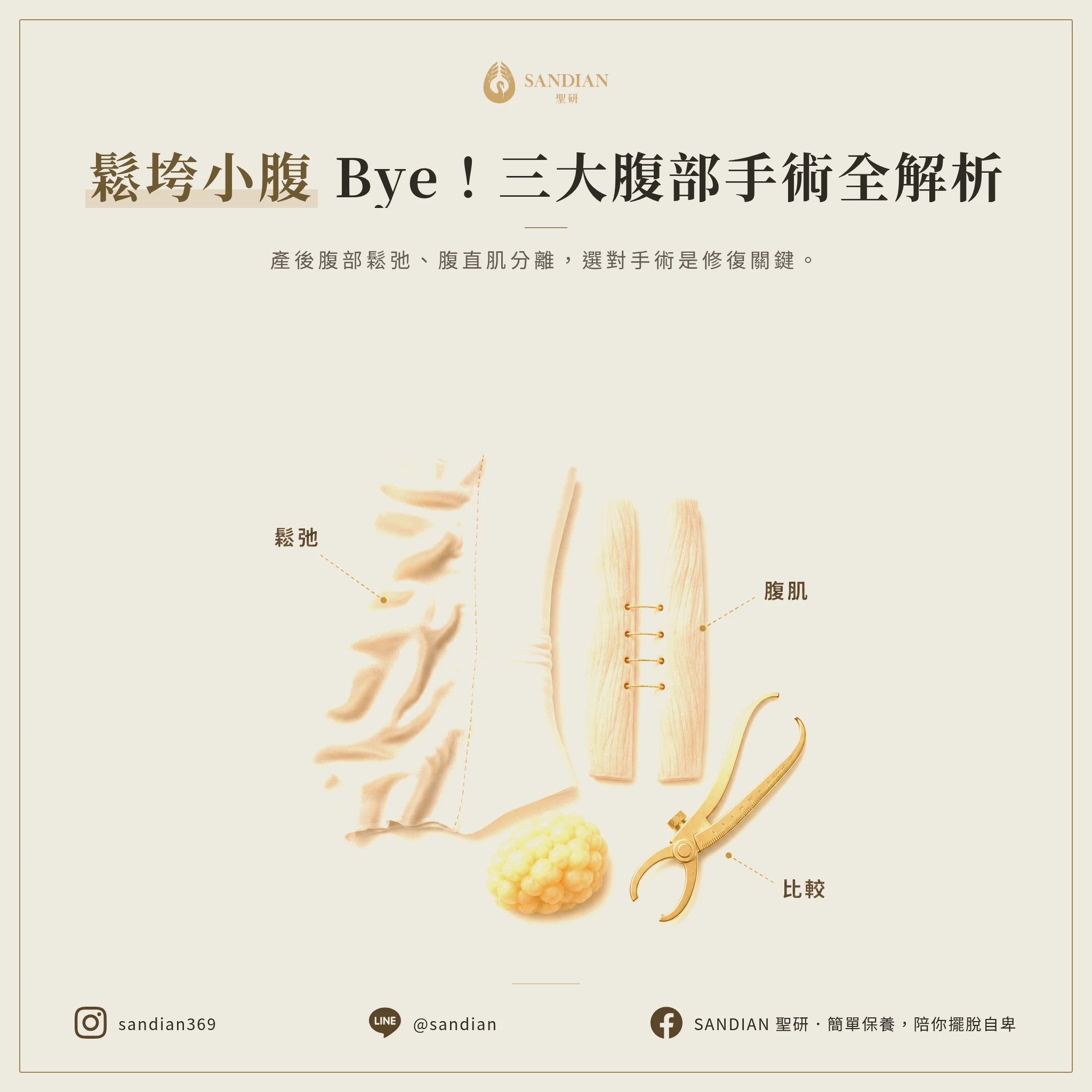 一、產後肚子為什麼會鬆弛?三種手術到底差在哪?