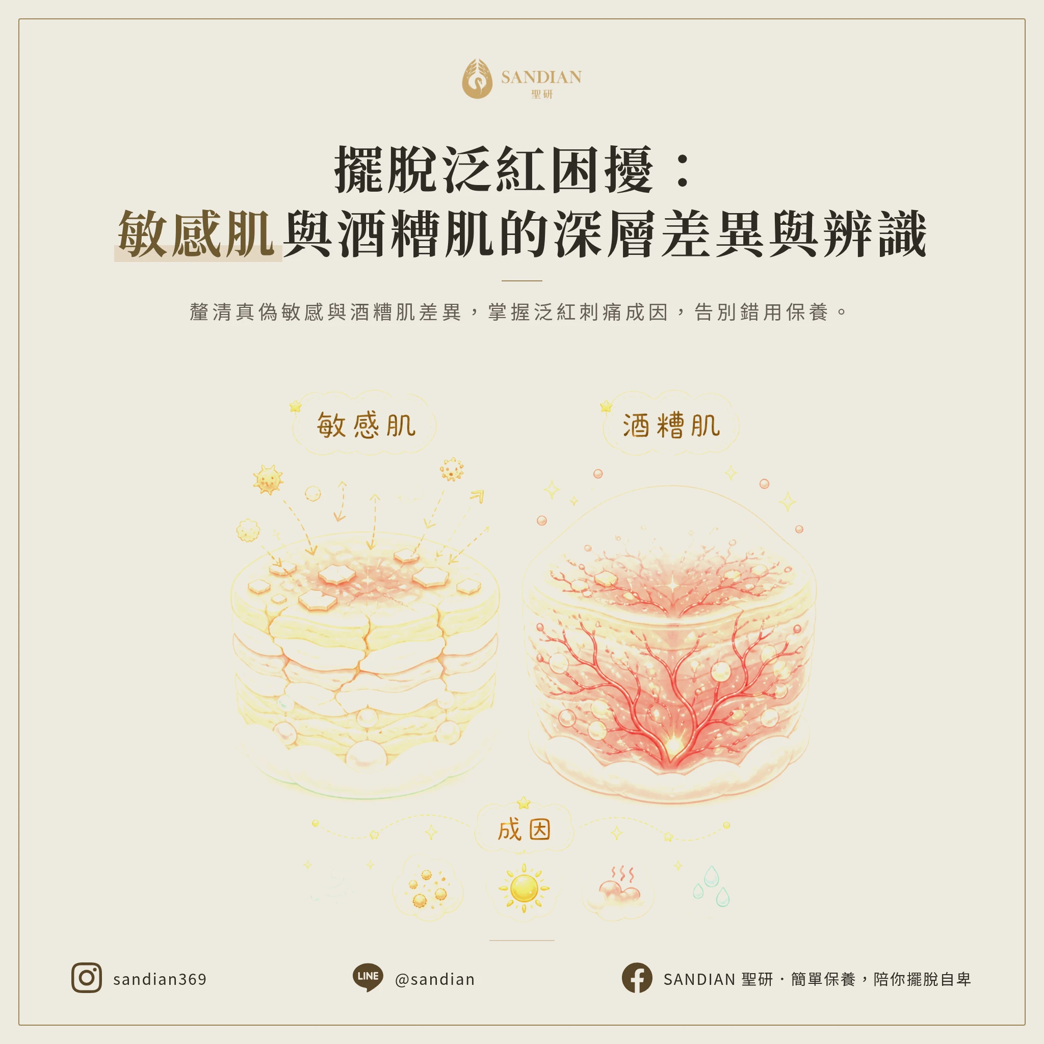 敏感肌 vs. 酒槽肌差異:臉部泛紅刺痛成因解析