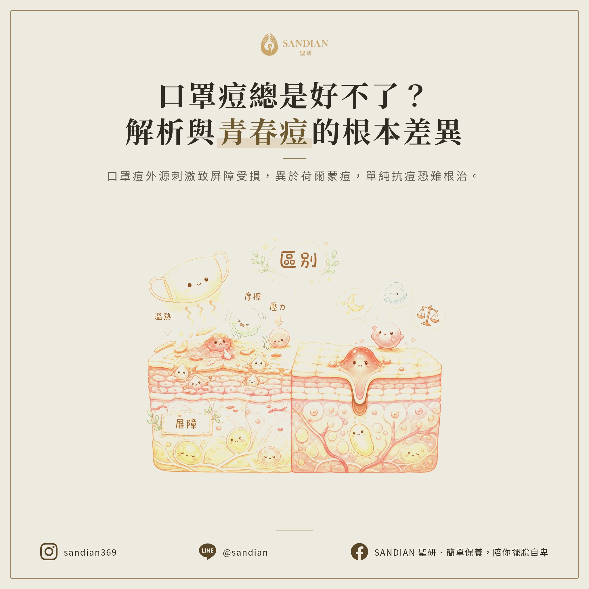 口罩痘與一般青春痘的區別:為何總是反覆發作?