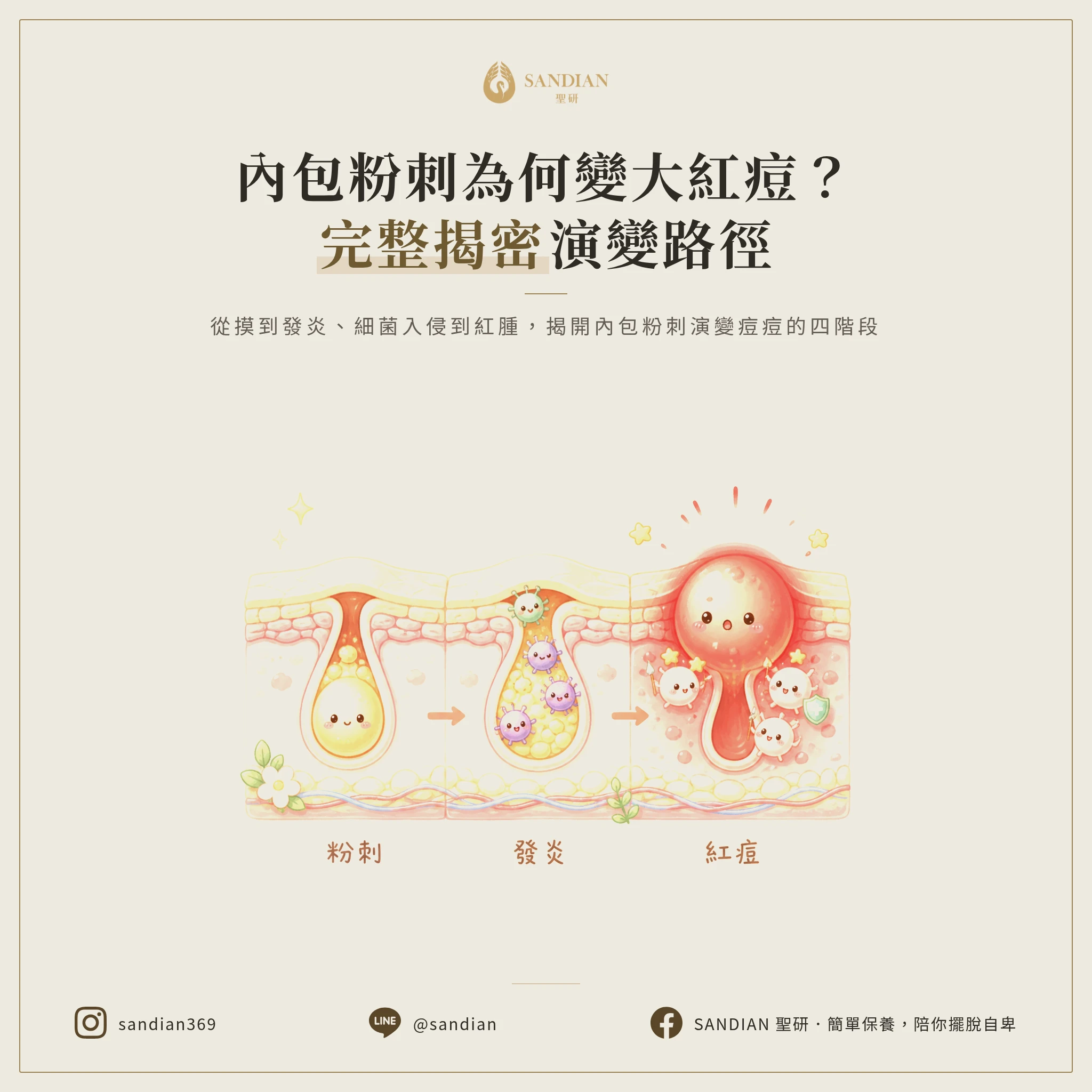 二、內包粉刺變紅痘的完整演變機制