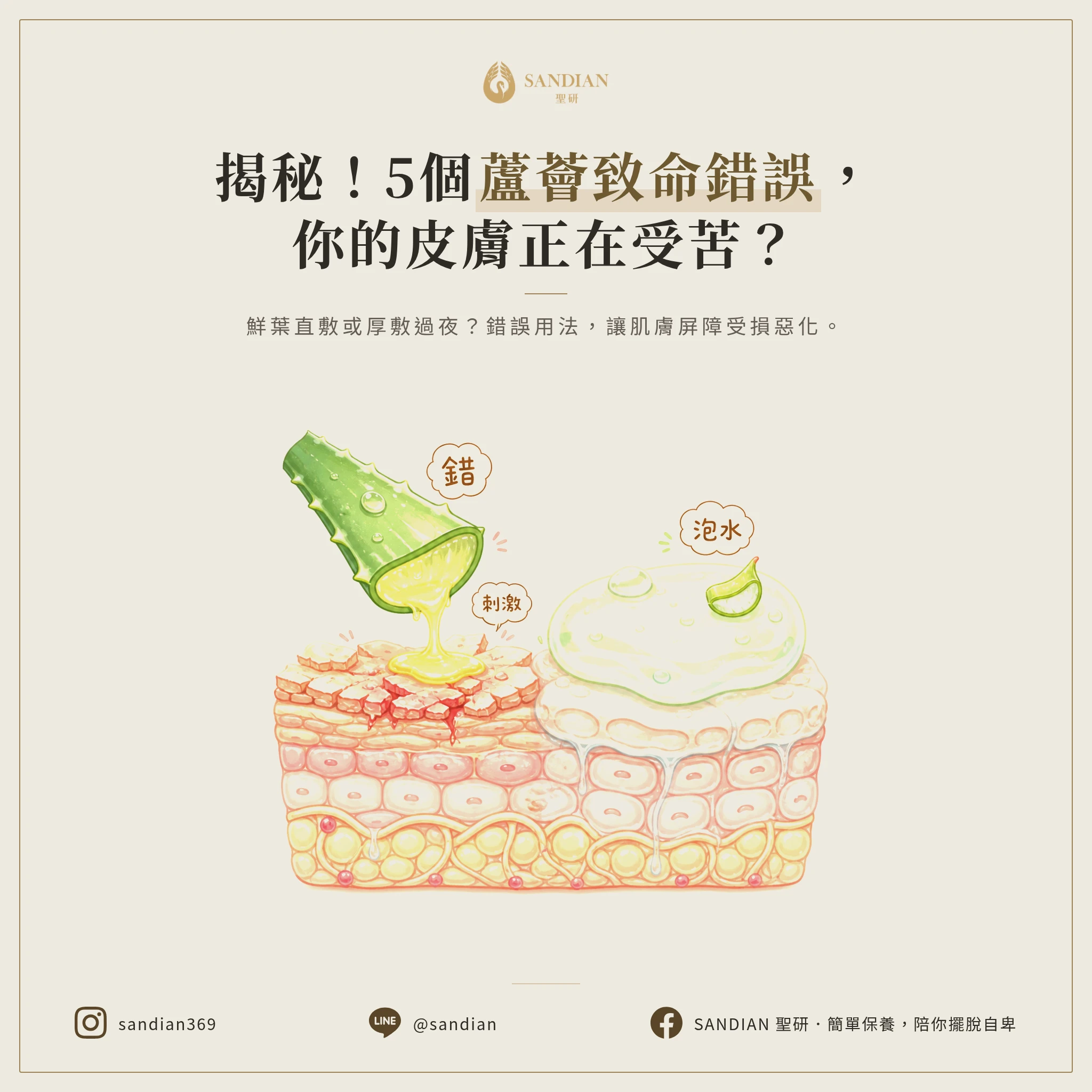三、5 個使用蘆薈的致命錯誤