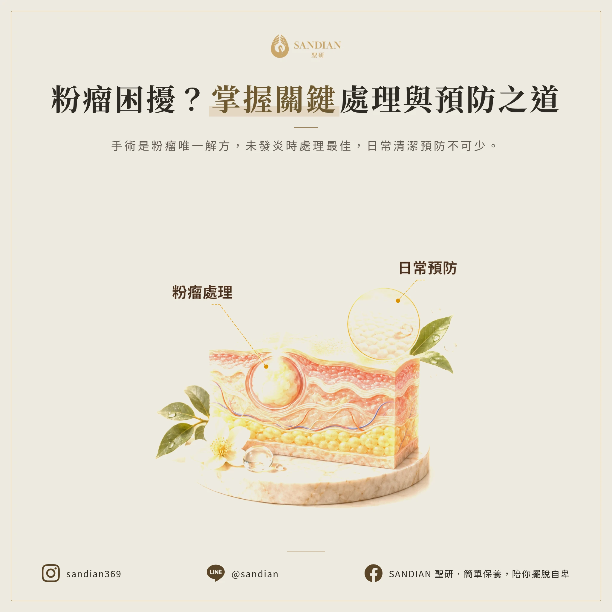 四、粉瘤的正確處理與日常預防