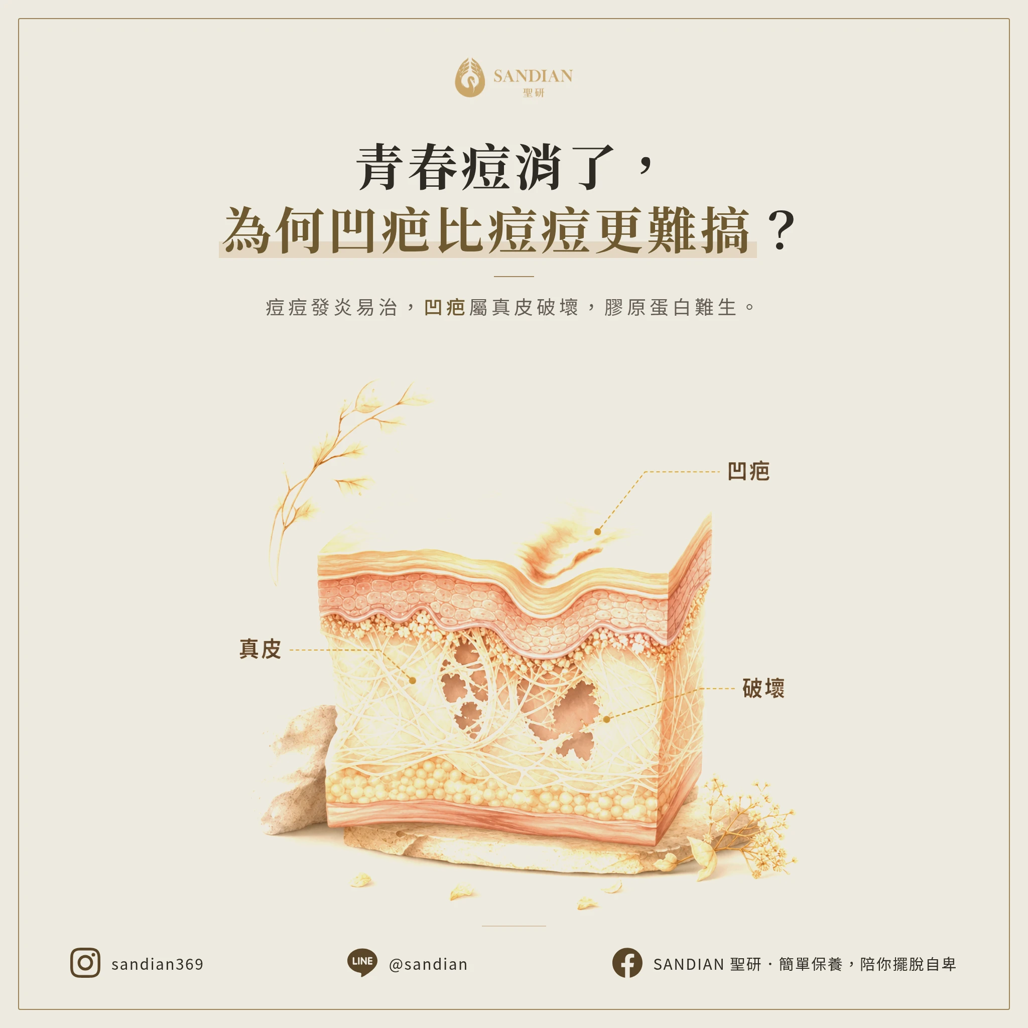 二、為什麼痘疤比痘痘更難治療