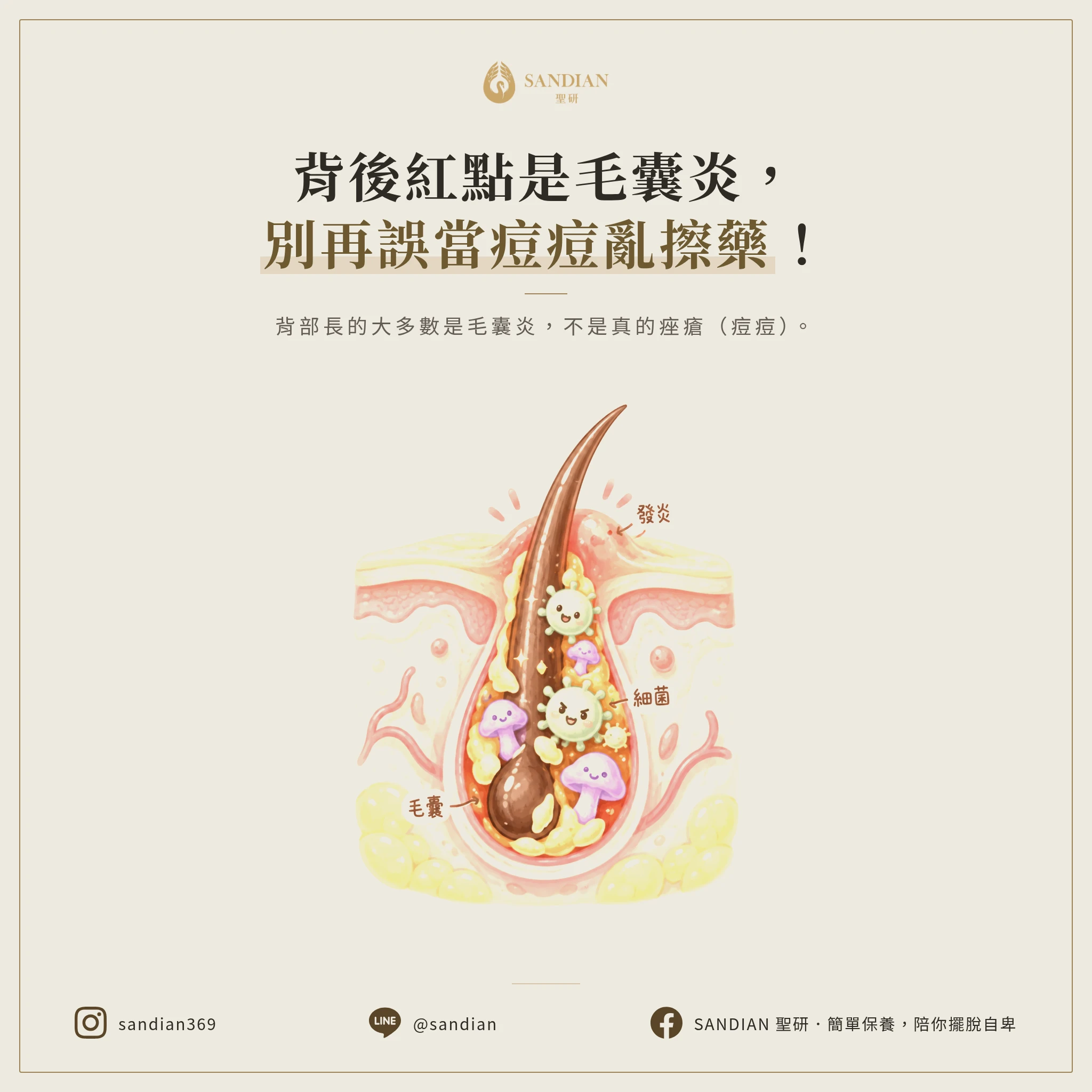 一、背部痘痘的 2 大真相:不是痘痘是毛囊炎