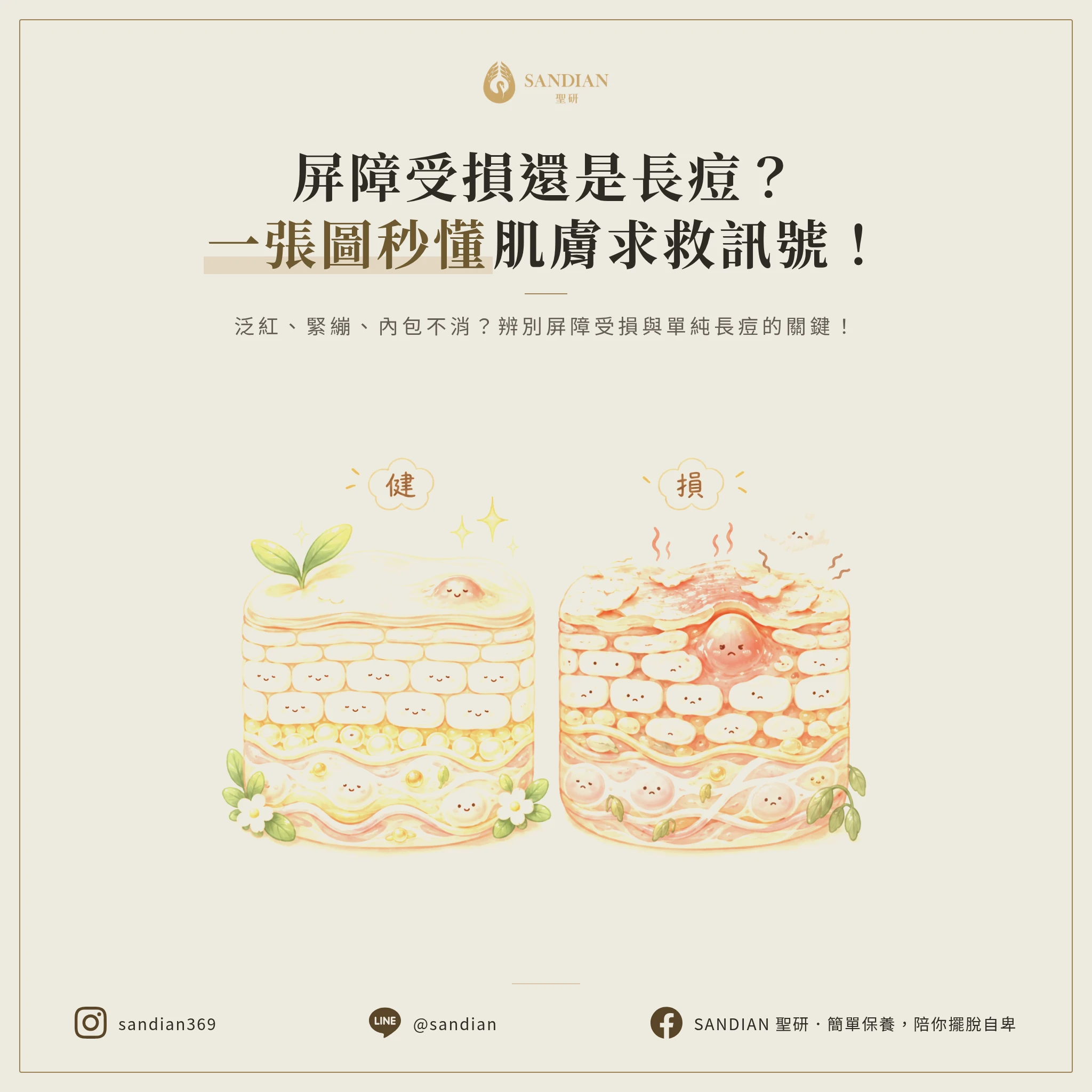 三、怎麼判斷自己是屏障受損還是單純長痘?