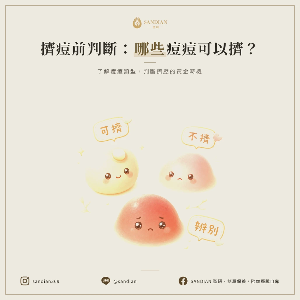 痘痘可以擠嗎?判斷哪些痘痘適合擠