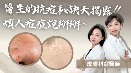 醫生的抗痘秘訣大揭露!煩人痘痘說掰掰~