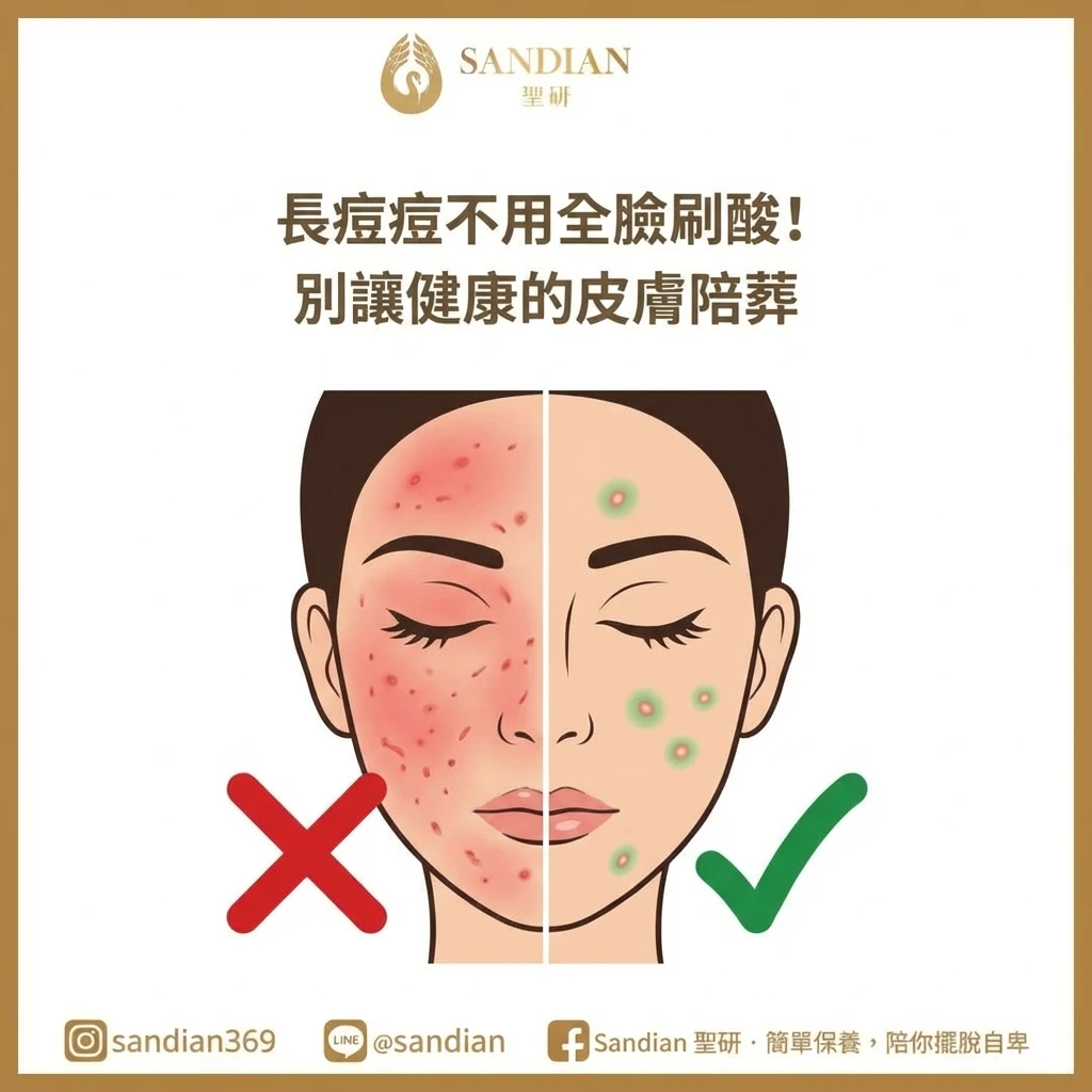 長痘痘不用全臉刷酸！抗痘傳教士 Alan 的 8 年血淚經驗：別讓健康的皮膚陪葬（含局部點塗教學）