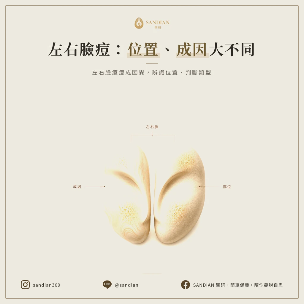 左右臉頰長痘痘的差異與部位辨識