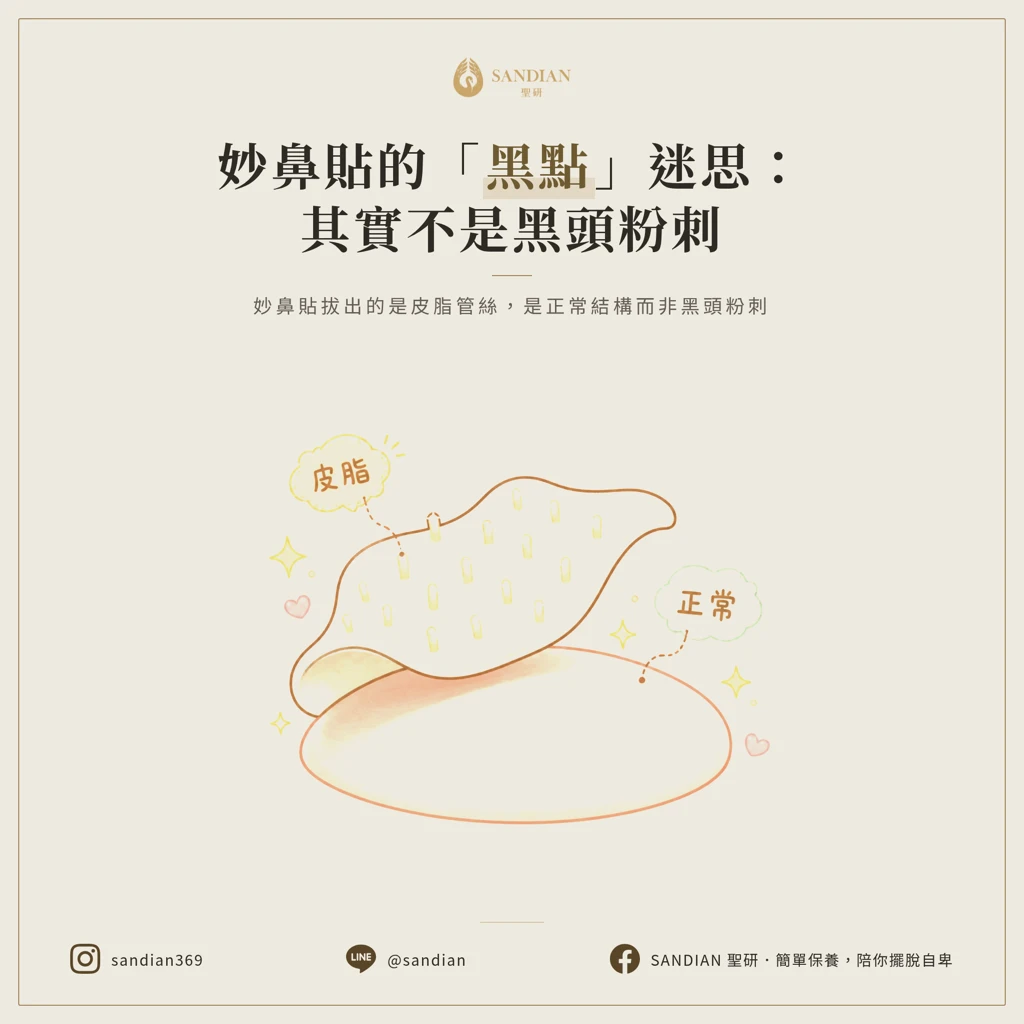 一、妙鼻貼拔起來的那些「黑點」,其實多半不是黑頭