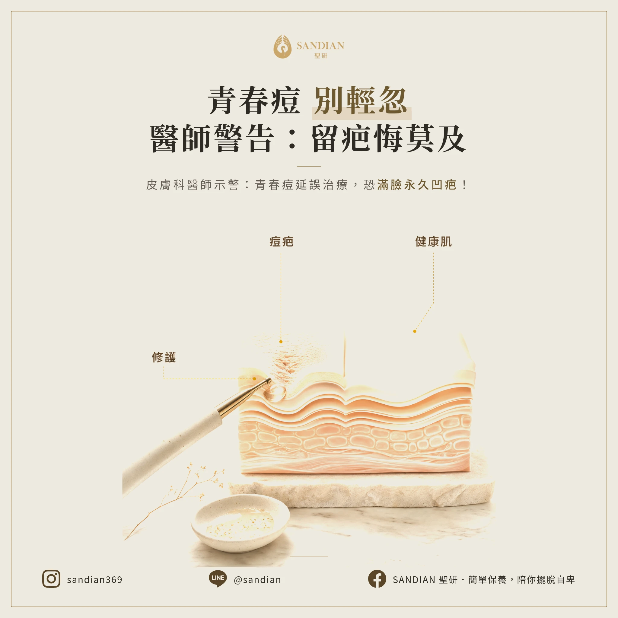 青春期長痘痘一定要看醫生嗎？皮膚科醫師警告：拖延不治療，小心滿臉永久凹疤
