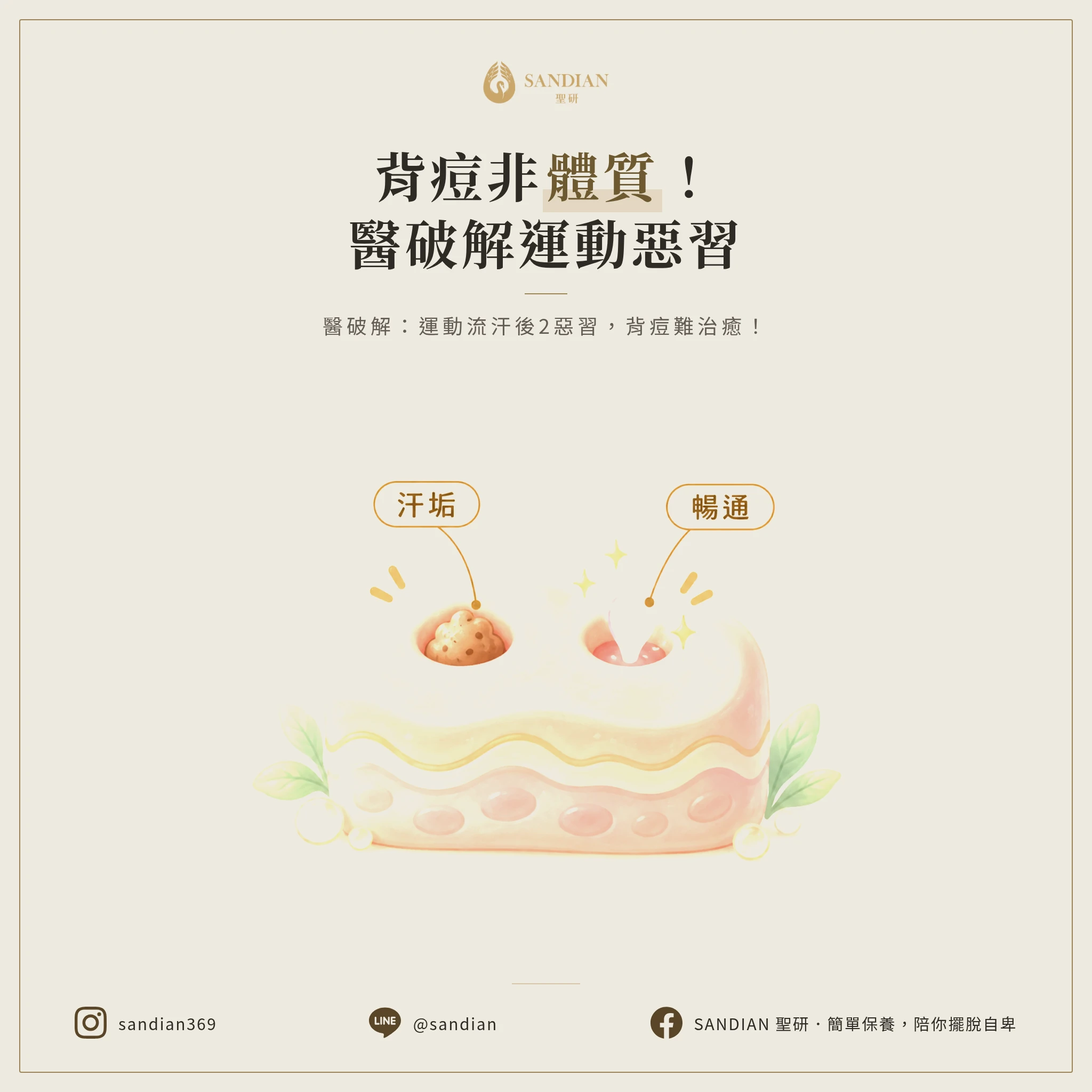 背後長痘痘不是體質！皮膚科醫師破解運動流汗2大爛習慣，不改吃藥也救不了