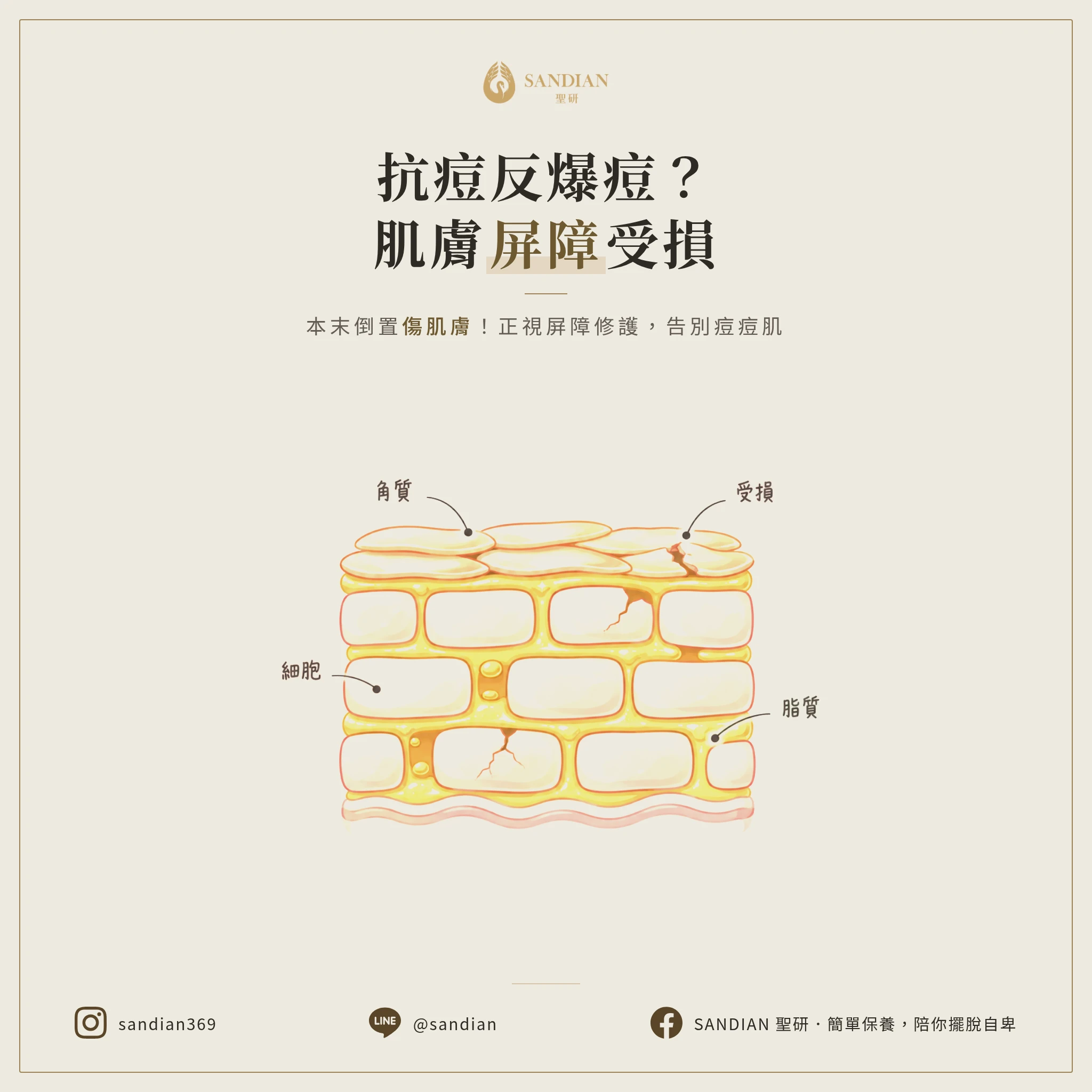 擦抗痘精華反而滿臉內包？肌膚屏障受損才是真兇，別再本末倒置了！