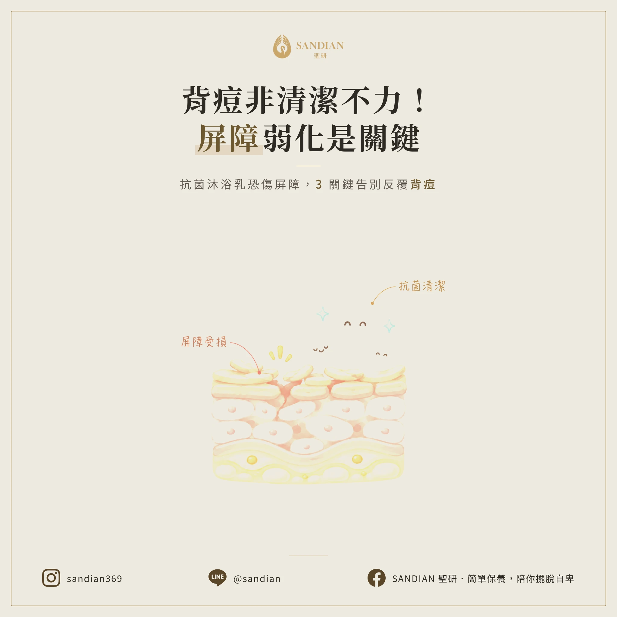 背痘不是沒洗乾淨！抗菌沐浴乳洗壞皮膚屏障，3 個關鍵讓背部痘痘不再反覆