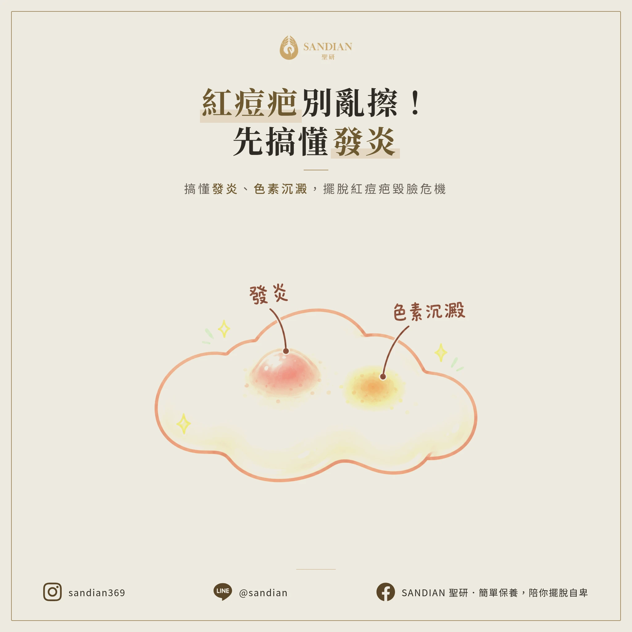 紅痘疤擦美白根本沒用！搞懂發炎和色素沉澱，別再亂擦東西毀臉