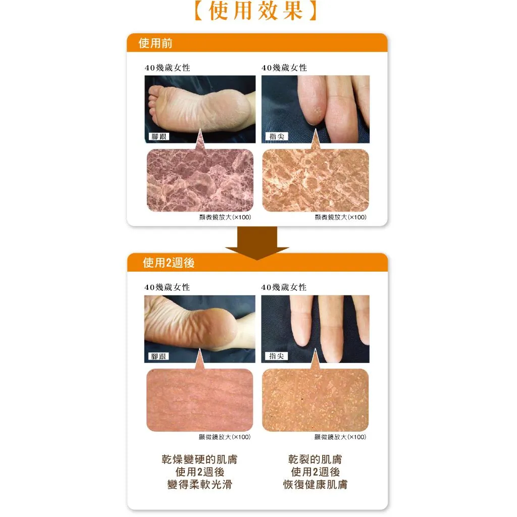 日本 yuskin 悠斯晶 乳霜180g 護手霜 護足霜 維他命 B2 玻尿酸 護膚 足 手 保濕