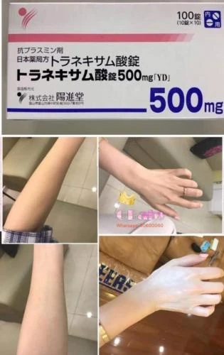 現貨 日本🇯🇵陽進堂美白片 秒殺所有美白丸 100錠/盒